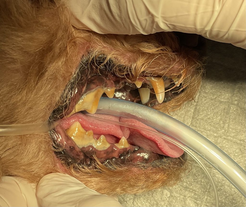 歯科処置前の歯石がついた状態
